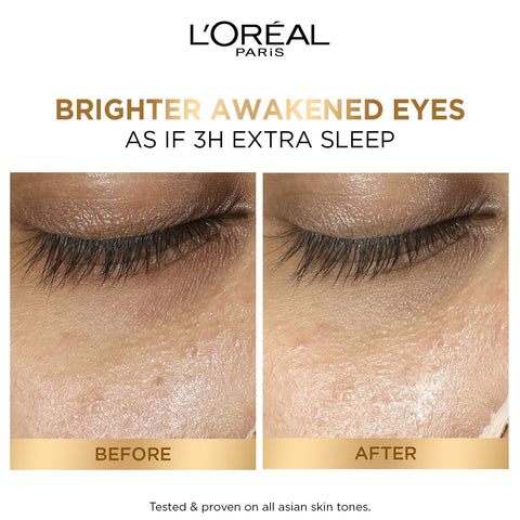 L'Oréal Paris Glycolic Eye Serum For Dark Circles &  Brighten Eyes 20ml