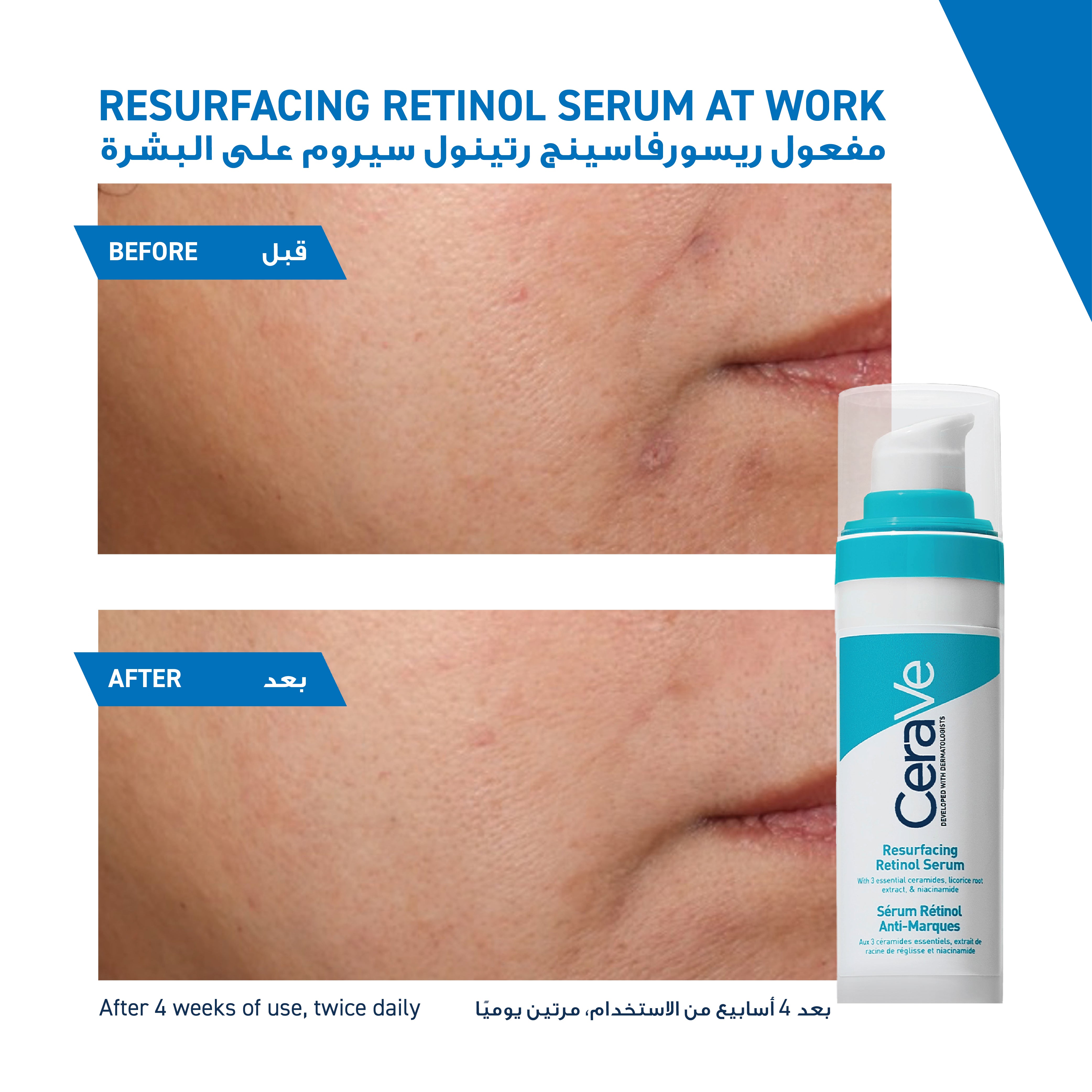 CERAVE RESURFACING RETINOL SERUM