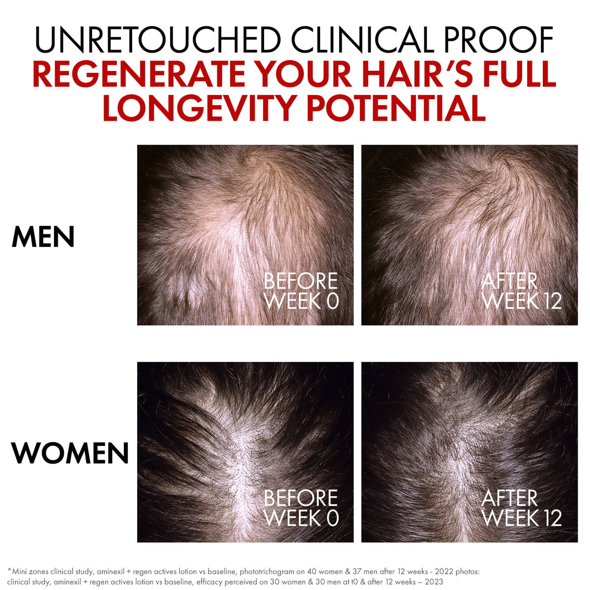 Vichy Dercos Aminexil Clinical R.E.G.E.N. Booster 90ml