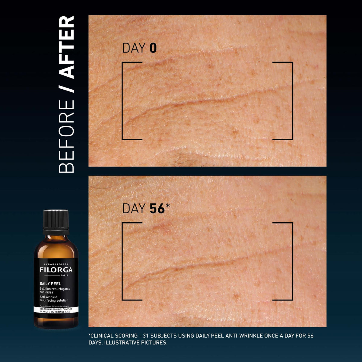 Filorga Daily Peel - Wrinkles 50ml