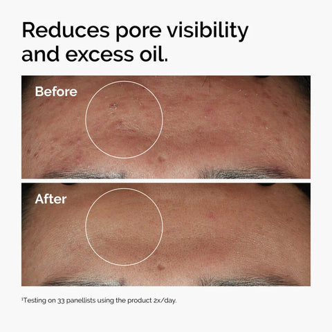NIACINAMIDE 10% + ZINC 1% 60ML/2FLOZ