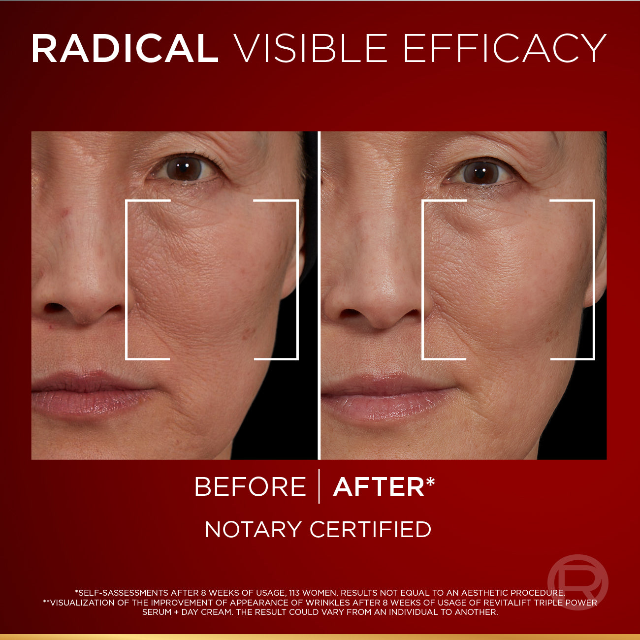 L’Oréal Paris Revitalift Triple Power Serum 30 ML