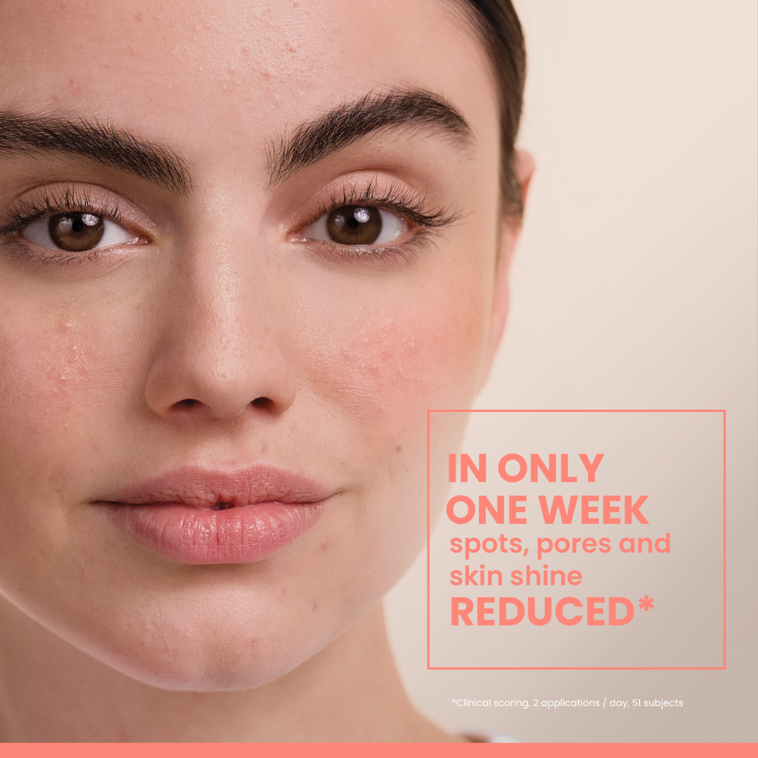 Avène Cleanance Comedomed Anti-Blemish Concentrate 30ml