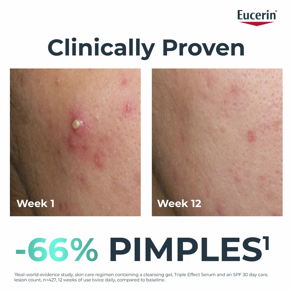 DermoPure Clinical Triple Action