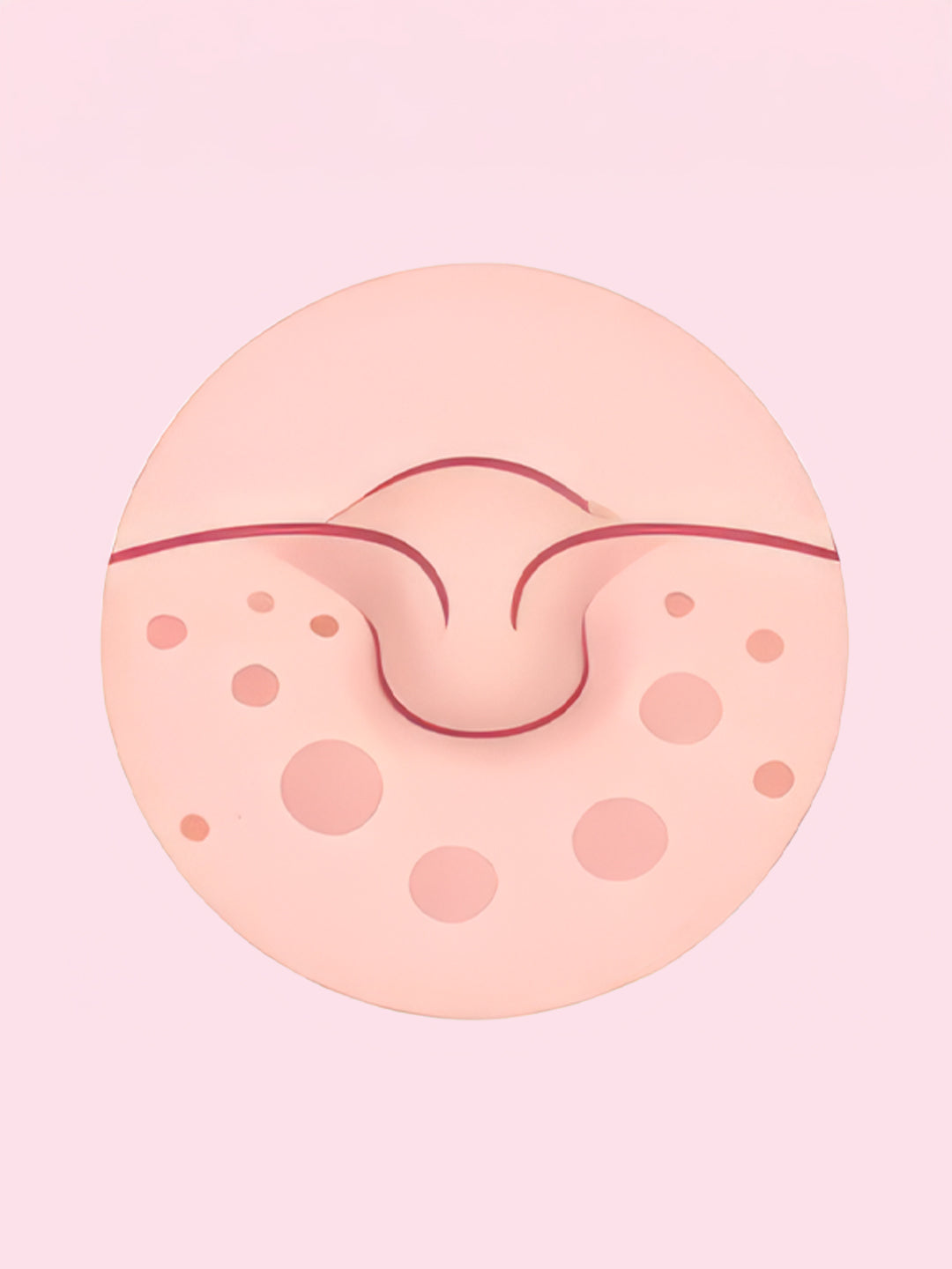 Skin Changes (orange peel)