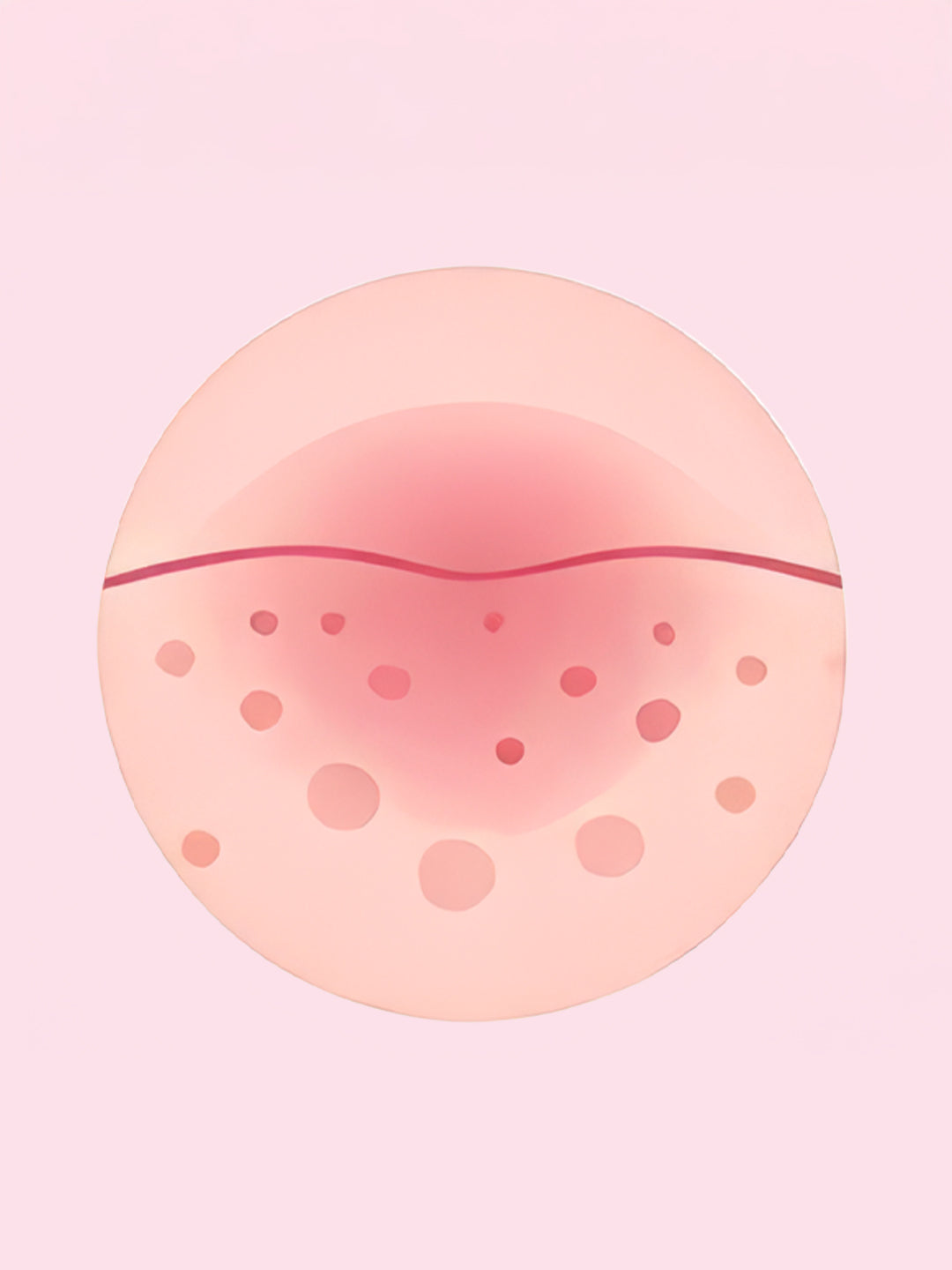 Redness Or Swelling