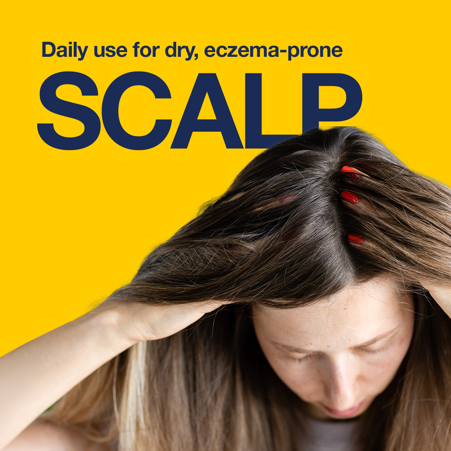 NIZORAL CARE DRY SCALP SHAMPOO 200ML