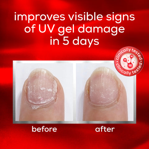 Essie Nail Care - To The Rescue UV Gel Damage
