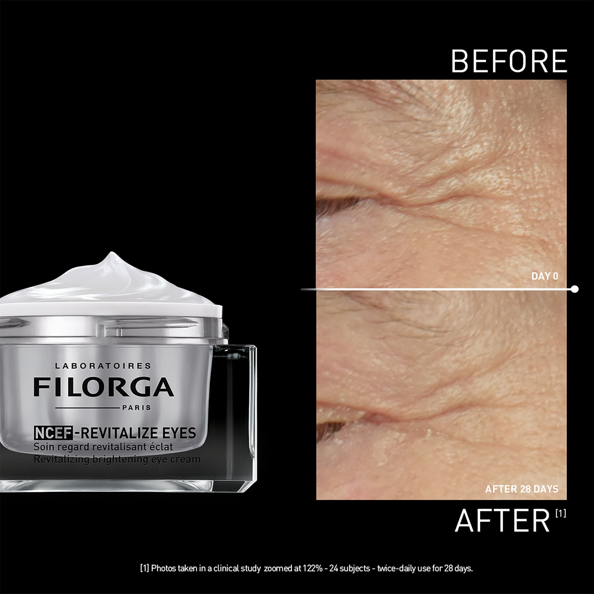 NCEF-REVITALIZE EYES   15ml
