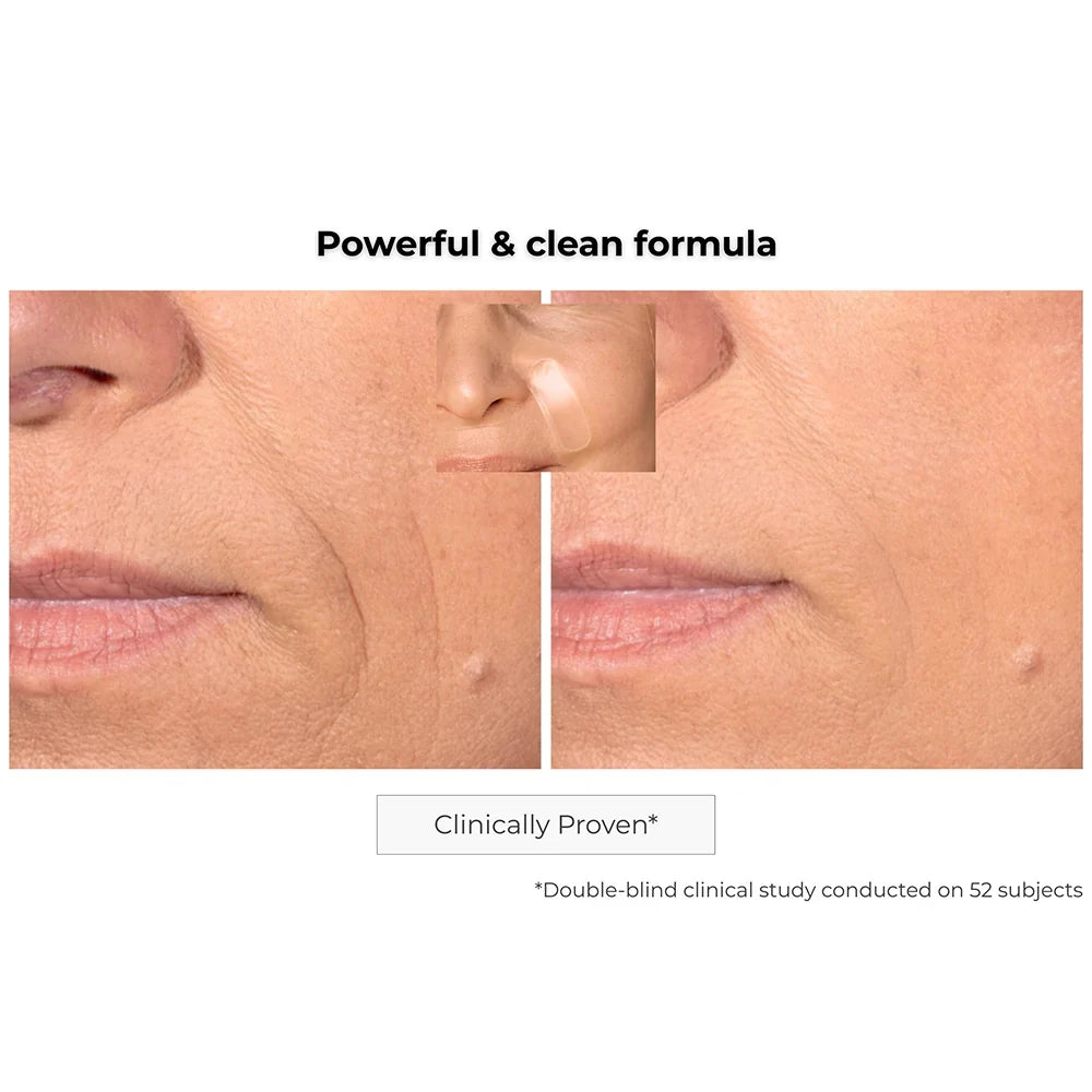Kósmopellis Microneedling Anti-Aging Patch 4x2 patches