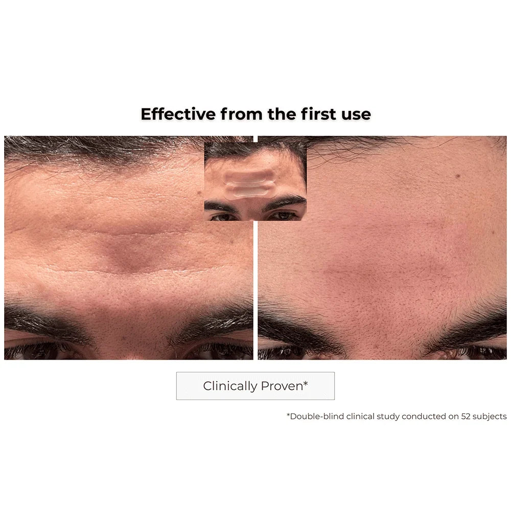 Kósmopellis Microneedling Anti-Aging Patch 4x2 patches