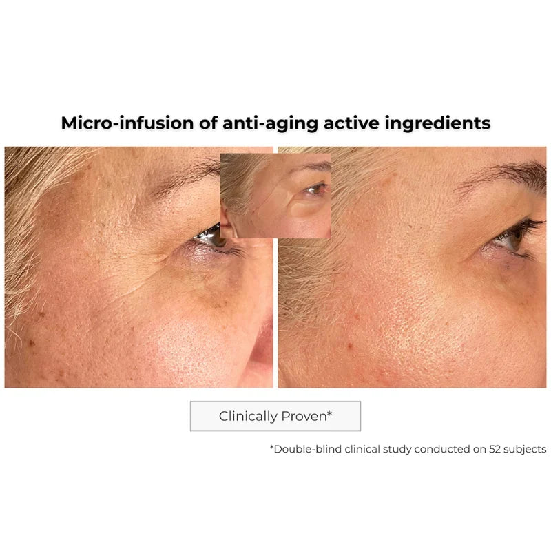 Kósmopellis Microneedling Anti-Aging Patch 4x2 patches