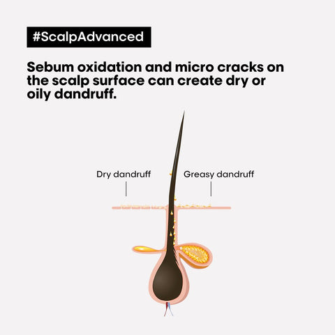 L’Oréal Professionnel | Scalp Advanced Anti-Discomfort Dermo-regulator shampoo | for sensitive scalps | SERIE EXPERT | 300 ml