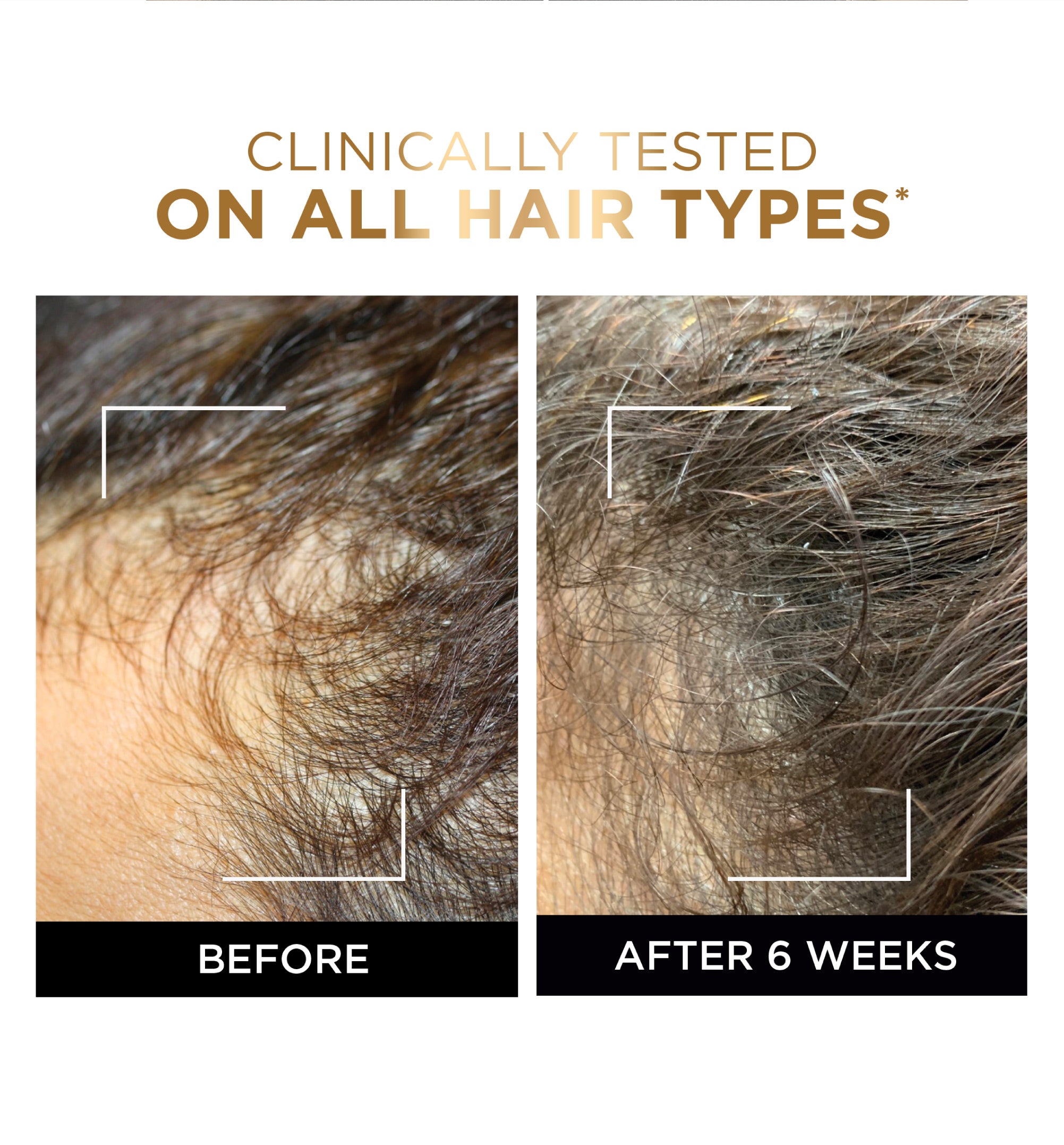 L’Oréal Paris Elvive Fall Resist Anti Hair-Fall Serum with Aminexil