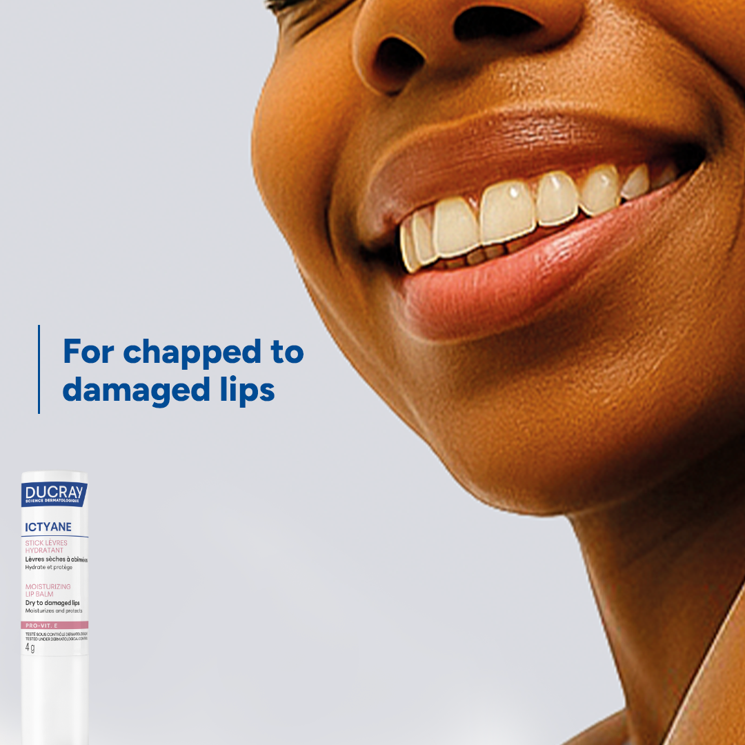Ducray Ictyane Moisturizing Lip Balm for dry to damaged lips 4g