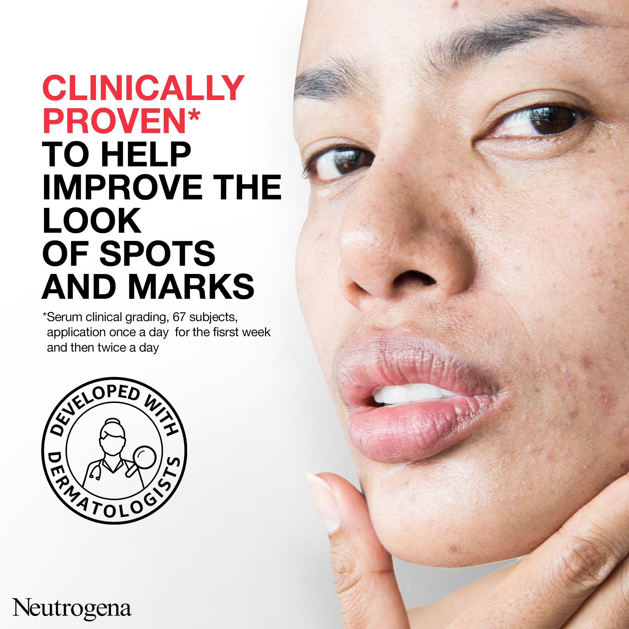 Neutrogena Spot Controlling+ Serum , Boosts Skin Radiance, powerful combination of Salicylic acid - a purifying agent and glycolic acid, 30ml