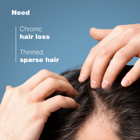 Anaphase+ Anti-Hair Loss Shampoo