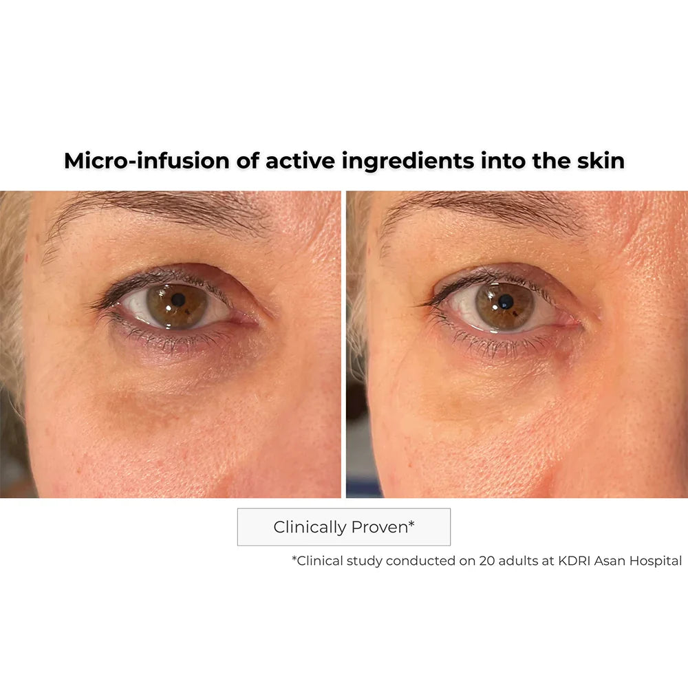 Kósmopellis Microneedling Eye Contour Patch 4x2 patches