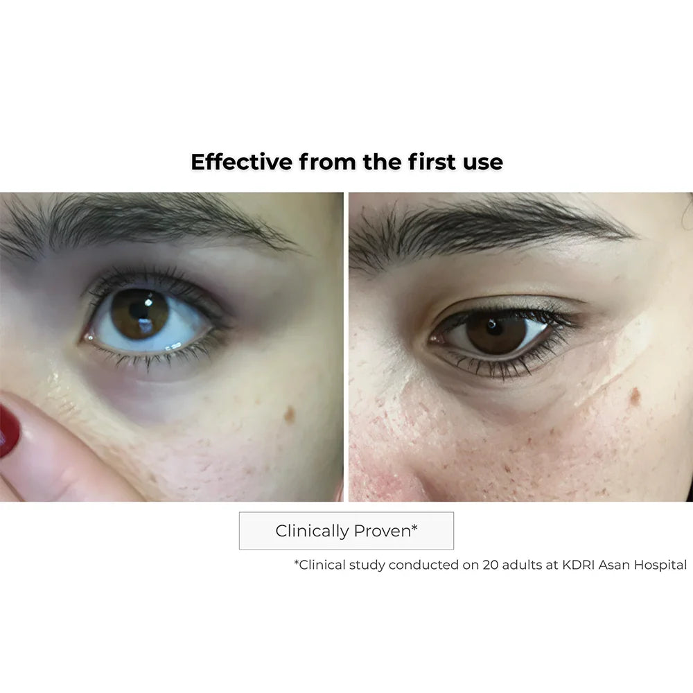 Kósmopellis Microneedling Eye Contour Patch 4x2 patches
