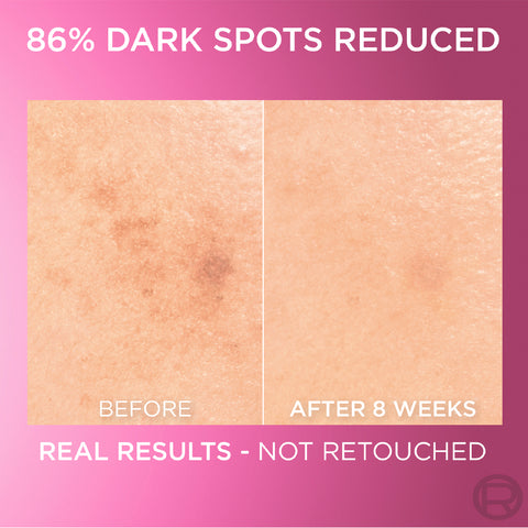 L’Oréal Paris Glycolic Bright Serum with 8% [Melasyl ™ + Glycolic Acid + Niacinamide] face serum for Dark Spots & Brightening 30ml