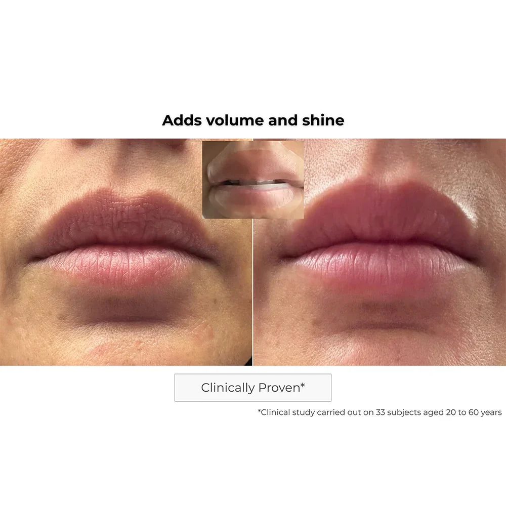 Kósmopellis Microneedling Lip Patch 4x2 patches