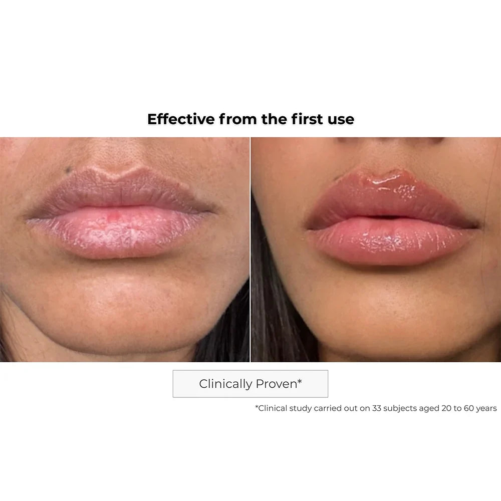 Kósmopellis Microneedling Lip Patch 4x2 patches