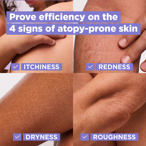 Mixa Panthenol Comfort Cream Jar - Anti-Scratching Cream - For Dry Skin, Atopy Prone Skin and Eczema - For Face, Hands & Body - 400 ml