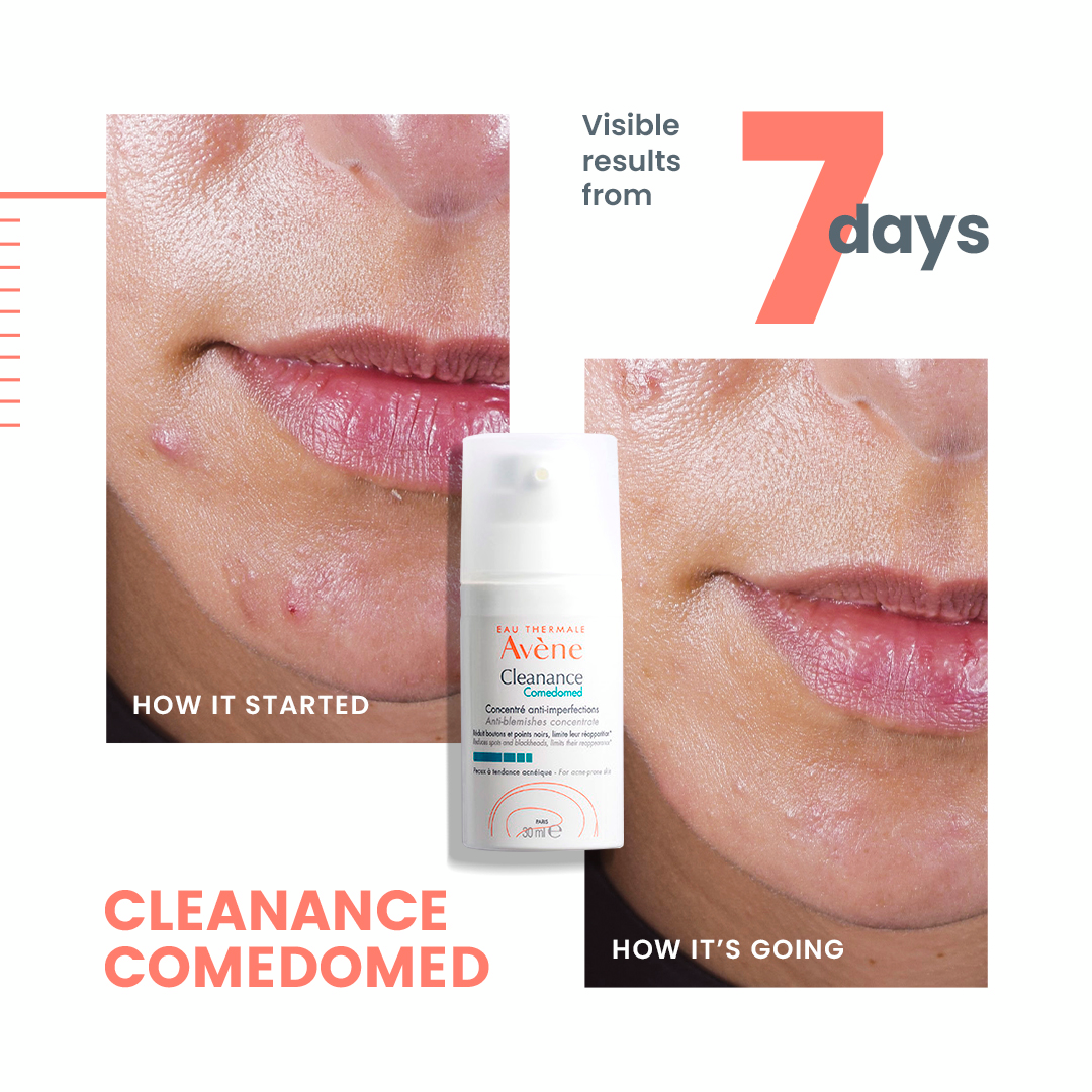 Avène Cleanance Comedomed 30ML