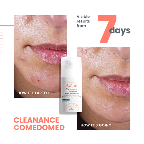 Avène Cleanance Comedomed 30ML