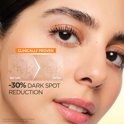 Garnier - Skin Active - Fast Bright - Vitamin C Water Gel Moisturizer - 48 Hours Hydration - Anti Dark Spots - 30 ML