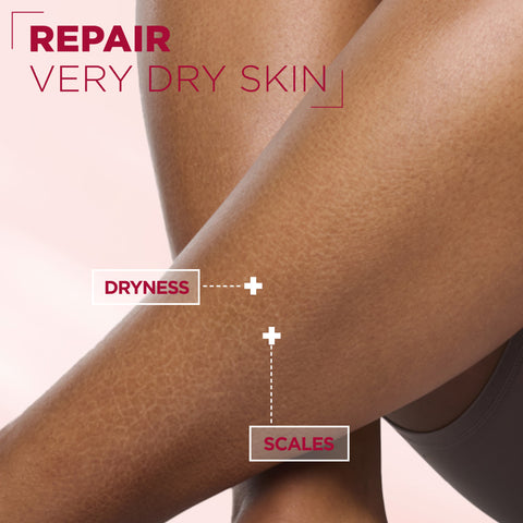 Mixa Urea Cica Repair Cream Jar - For Keratosis Pilaris, Dry Rough Fragile Skin & Tiny Reddish Bumps - For Face, Hands & Body - 400 ml