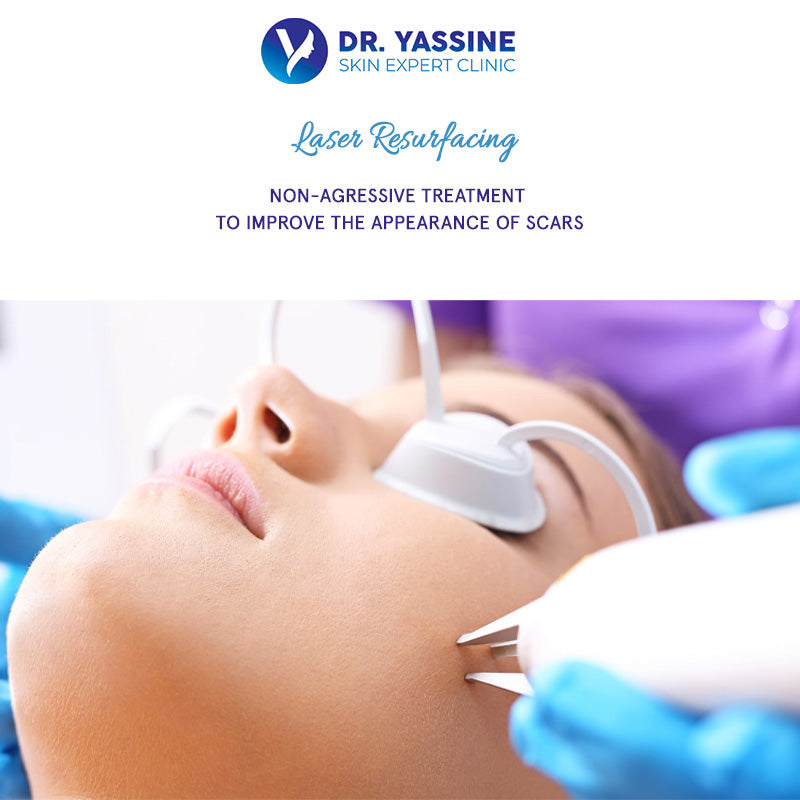 Laser Resurfacing For Scars