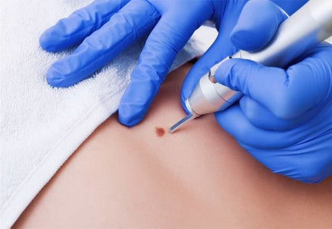 Dermatological Surgery
