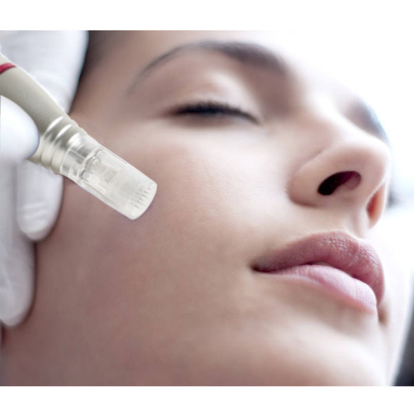 Microneedling